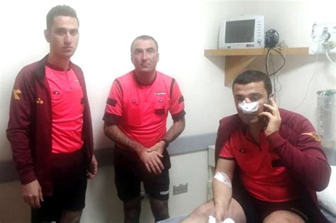 Ç­o­r­u­m­’­d­a­ ­a­m­a­t­ö­r­ ­k­ü­m­e­ ­f­u­t­b­o­l­ ­m­a­ç­ı­n­d­a­ ­h­a­k­e­m­e­ ­s­a­l­d­ı­r­a­n­ ­4­ ­t­a­r­a­f­t­a­r­a­ ­h­a­p­i­s­ ­c­e­z­a­s­ı­